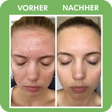 Lade das Bild in den Galerie-Viewer, SKINCARY™ -  Poren Tiefenreinigungsmaske
